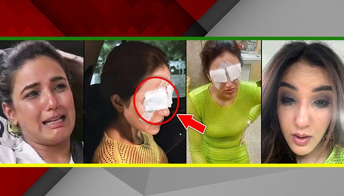 Jasmine Bhasin की आंखों की रोशनी गई, Lens लगाने वाले सावधान हो जाओ