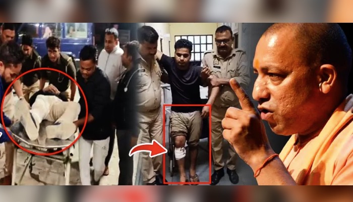 लड़की पर तेजाब फेंकने वाले बुर्के वाले को ‘बाबा’ की पुलिस ने चाल टेढ़ी कर दी