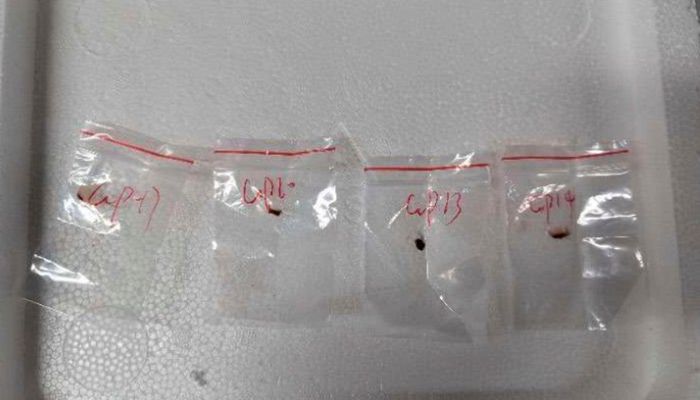 जिनपिंग की जहरीली साजिश! अमेरिका में 'एग्रो टेररिज्म' के लिए खतरनाक फंगस के साथ भेजे चीनी एजेंट, ऐसे हुआ खुलासा