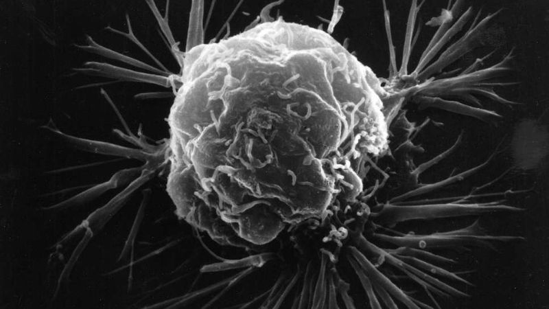 कैंसर रिलैप्स: शरीर में दिखें ये लक्षण तो हो जाएं अलर्ट! वक्त रहते पहचान कर बचा सकते हैं जान