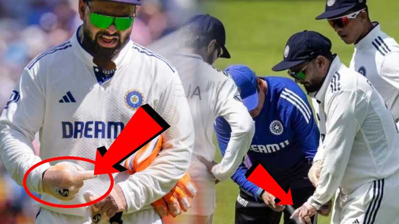 IND vs ENG: ऋषभ पंत की चोट को लेकर बीसीसीआई ने दिया अपडेट, जानिए कितनी गंभीर है चोट