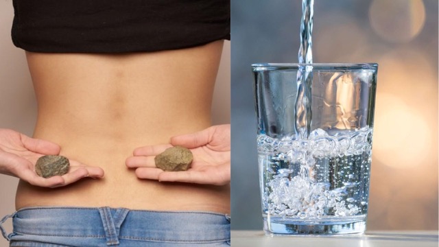 अगर नहीं मानी बात तो किडनी में बन जाएगी पथरी, दिनभर में कम से कम इतने गिलास पानी पीना शुरु कर दें