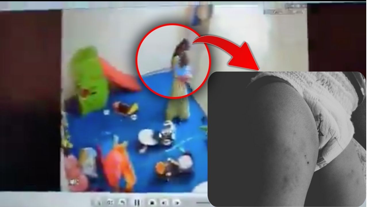 पहले जड़े थप्पड़, फिर बेल्ट से पीटा, मन नहीं भरा तो जमीन पर पटका और दांत से काटा, नोएडा के डे-केयर में 15 महीने की बच्ची के साथ हैवानियत