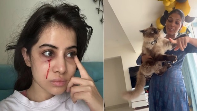 उर्फी जावेद को लगी चोट, चेहरे से बहता दिखा खून, Video शेयर कर बोलीं- ये बिल्ली शैतान है