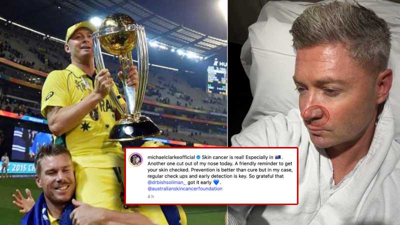 माइकल क्लार्क ने करवाई कैंसर की सर्जरी, तस्वीर शेयर कर फैंस से की ये अपील