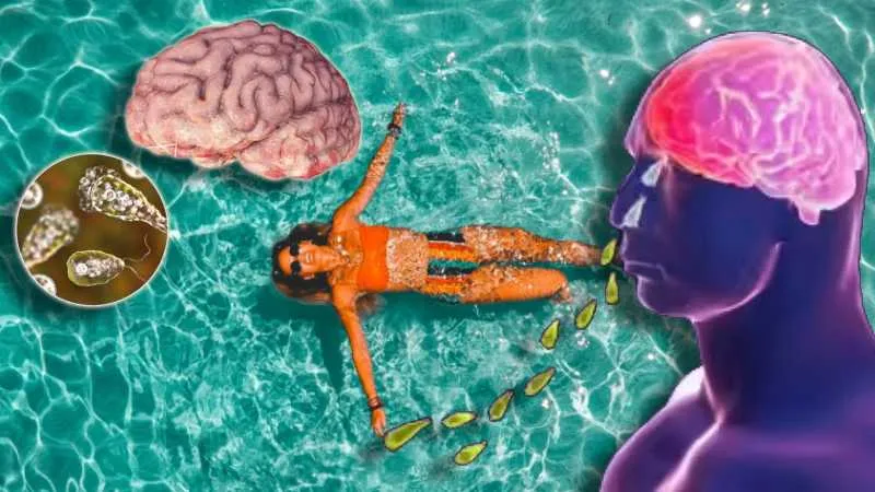 अब नहाते समय रहना होगा सावधान! एक गलती साबित हो सकती जानलेवा, मस्तिष्क खाने वाले अमीबा से हुई 17 लोगों की मौत