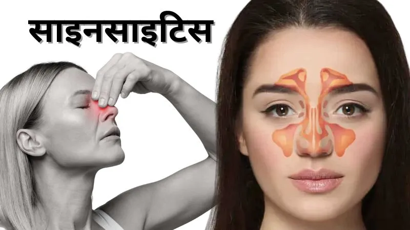 अगर सिरदर्द और बंद नाक को किया नजरअंदाज, तो हो सकता है साइनसाइटिस! आयुर्वेद में हैं राहत पाने के उपाय