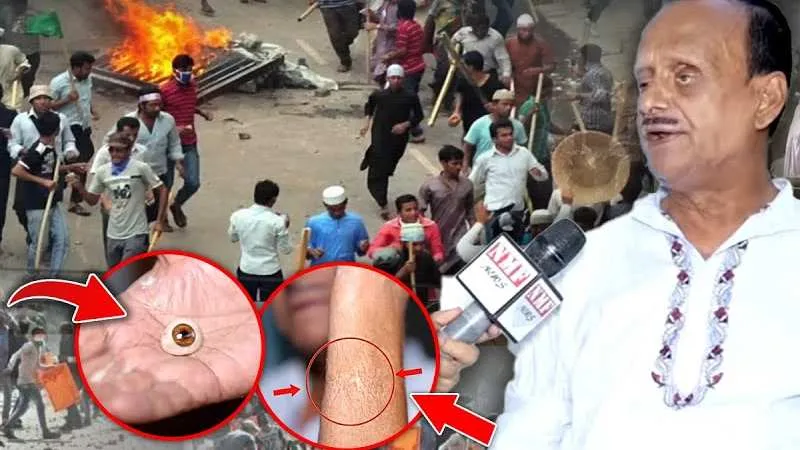 'मुस्लिमों ने हिंदुओं को मारा, मुस्लिम डॉक्टरों ने इलाज नहीं किया, कौम से बढ़कर कुछ नहीं! Araria