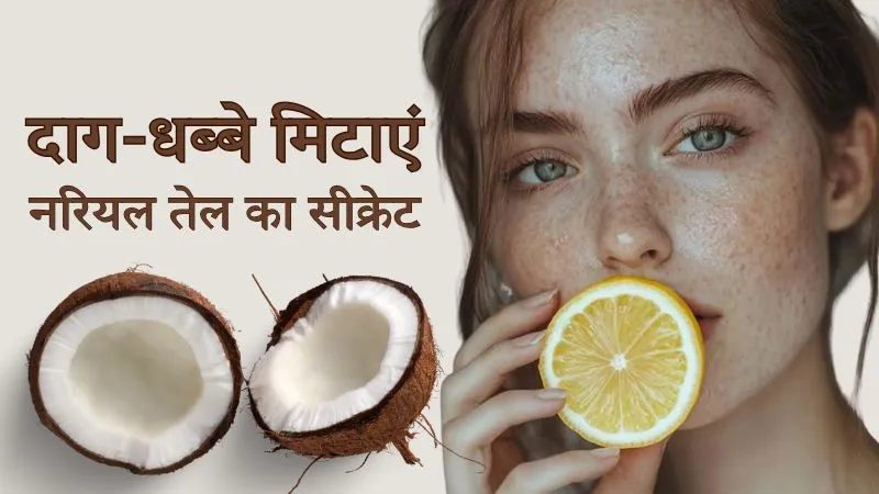 Home Remedy : नारियल तेल में एक सामग्री मिलाकर झाइयों और दाग-धब्बों को करें खत्म