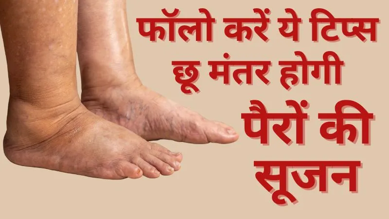 अधिक देर तक खड़े रहने या बैठने से सूज जाते हैं पैर? फॉलो करें ये टिप्स तुरंत मिलेगा आराम