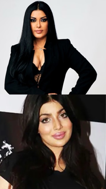 बॉलीवुड की इन हिरोइनों को प्लास्टिक सर्जरी पड़ गई थी महंगी, नंबर 3 वाली खूब हुई थी ट्रोल!