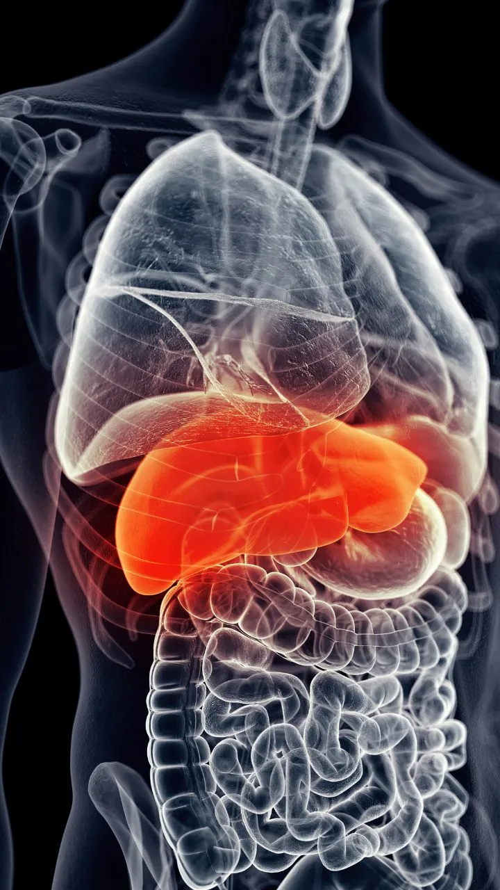 फैटी लिवर: समय रहते सुधारें जीवनशैली, आयुर्वेदिक नुस्खों से मिलेगी निजात